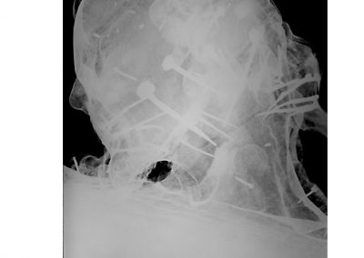Radiografia-testa-1a